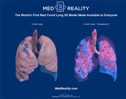 Covid_Lung_Release